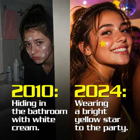 Starface meme ad example: The Evolution of Pimple Care